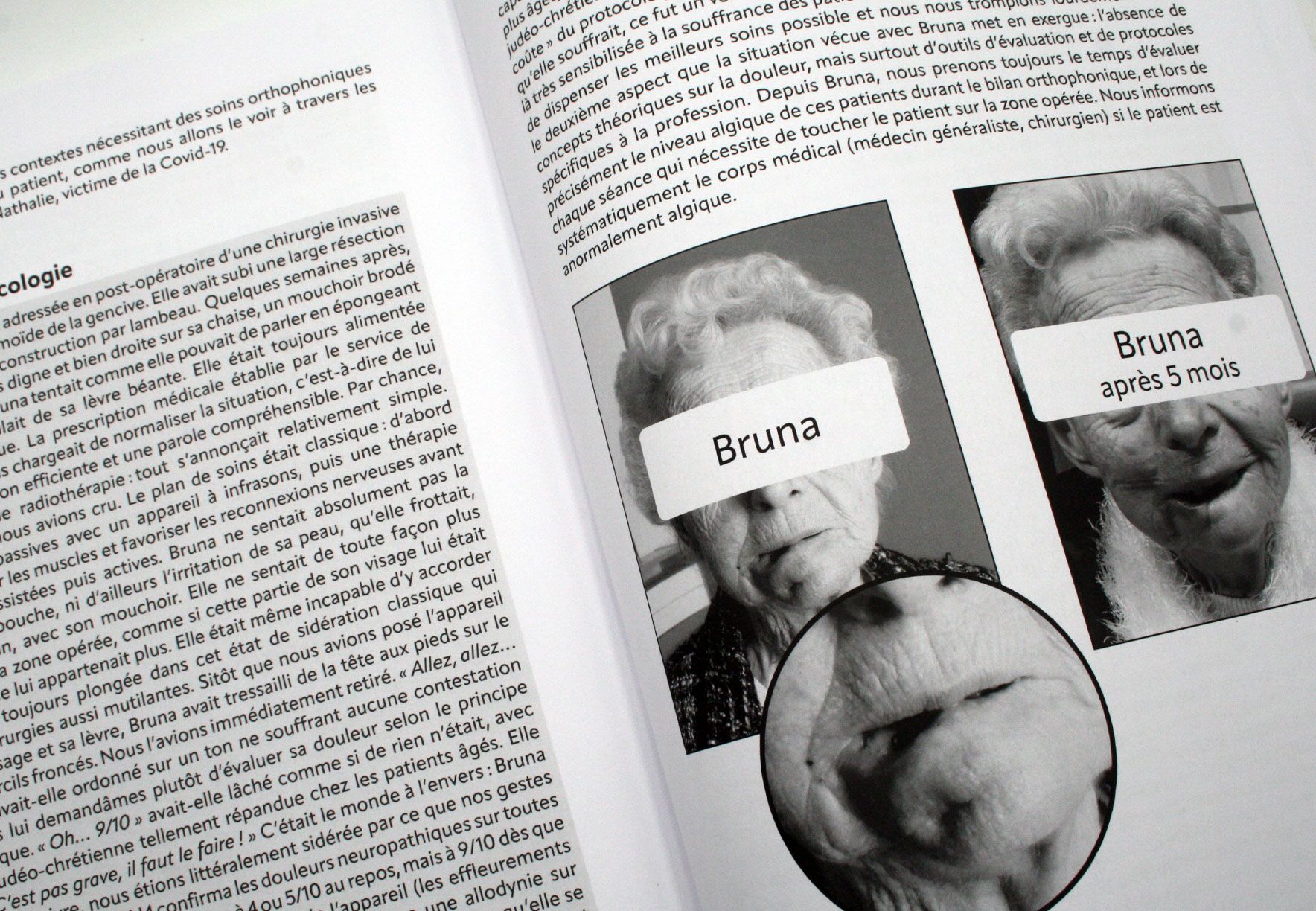 Image sur le produit La douleur en Orthophonie, de la Théorie à la Pratique